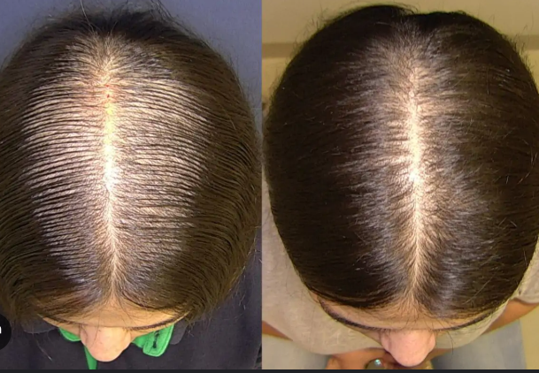 Vista previa del protocolo Código Capilar