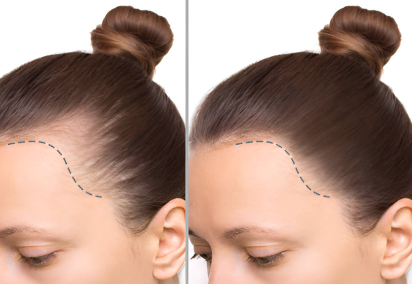 Rituales caseros capilares